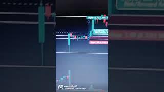 intraday trading tricks in hindi || Intraday Trading Tips in Hindi|| #arya#singh#trader #intraday