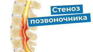 Абсолютный стеноз позвоночного канала | Операция | Лечение