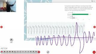 AETCM ECG MADE SUPER SIMPLE | QUESTION PAPER 1 DISCUSSION | Q&A from Online Exam.