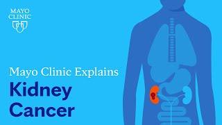 Mayo Clinic Explains Kidney Cancer