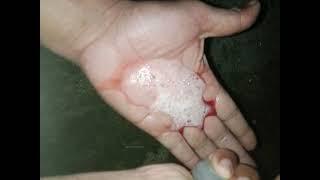 mastitis in buffalo (blood+water) dd ramawat#