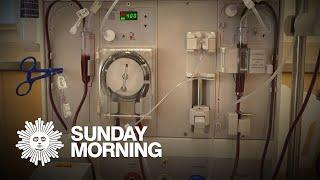 Kidney dialysis industry accused of maximizing profits over patients