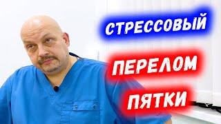 Болит пятка причины | Стрессовый перелом пятки | Григорий Перевезенцев