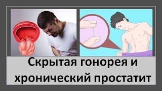 Скрытая гонорея и хронический простатит