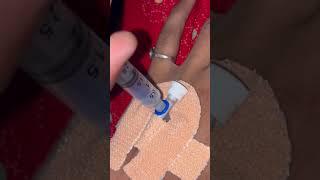 How to give injections in IV Cannula | iv injection