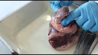 Louise shuttle worth dissection