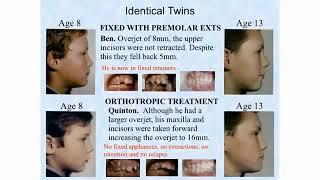 Eric Davis Dental - Dr. John Mew The Twin Study Comparison of Techniques