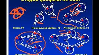 Особенности изменения печени у детей с муковисцидозом