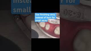 ADEX Exam Prep - Why Finishing Strips Are Safer Than Burrs