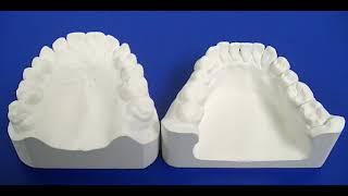 Understanding and Using the Great Lakes Anterior Deprogrammer for Occlusal Therapy