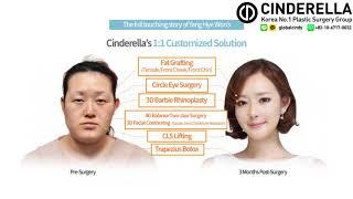 My Plastic Surgery Experience | Cinderella Clinic Korean Plastic Surgery White Swan, Yang Hye Won