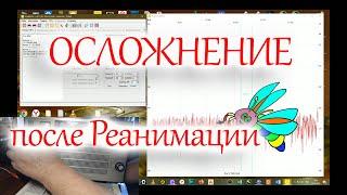 Первые осложнения после ремонта УПЧ ЧМ радиоприемника Океан-214