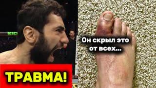 ТРАВМА Наимова - Почему молчал? UFC не знали об этом