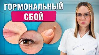 Первые симптомы проблем! Почему происходит гормональный сбой?