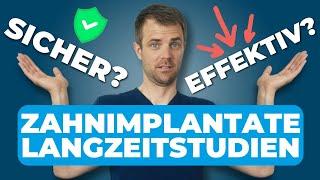 Langzeitstudien zu Zahnimplantaten: Wie sicher und effektiv sind sie wirklich?