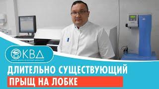  Длительно существующий прыщ на лобке. Клинический случай №733