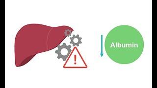 Getting to know albumin physiology