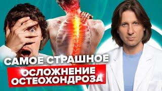 Что будет, если не лечить остеохондроз? Какие симптомы, говорят о страшных осложнениях