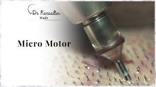 Micro Motor / DR KARAALTINHAIR