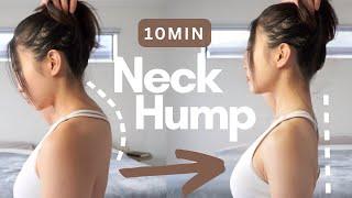 10min Fix Neck Hump & Forward Head | Correct Posture | Best Neck Stretch