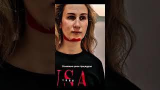 Логопедическое тейпирование подъязычной области. Логопед Косматькова Алеся.