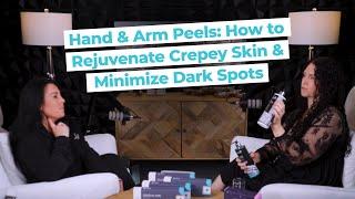 Hand & Arm Peels: How to Rejuvenate Crepey Skin & Minimize Dark Spots