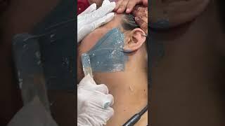 Brazilian official waxing #youtubeshorts #skincare #subscribe #facialhairremoval like