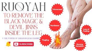 Ultimate Ruqyah to Remove Black Magic & Devil Inside Legs causing Movement,Pain Numbness,Burning etc