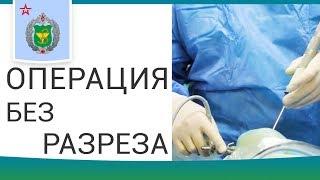  Этапы артроскопических операций и реабилитация после. Артроскопические операции. 12+