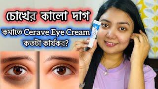 ডার্ক সার্কেল কমাতে CERAVE Eye Repair Cream কতটা কার্যকর? - Cerave Brand