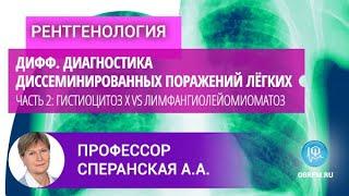 Профессор Сперанская А.А.: Дифф.диагностика диссеминированных поражений лёгких. Часть 2