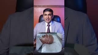 Neck Stiffness and Pain? Discover How to Treat Cervical Spondylosis | Dr. Arun Kannan #neckpain