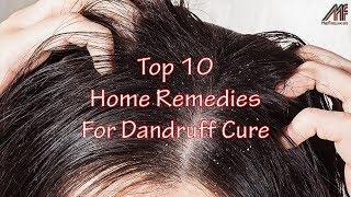 10 Home Remedies For Dandruff Cure  Dandruff Treatment at Home