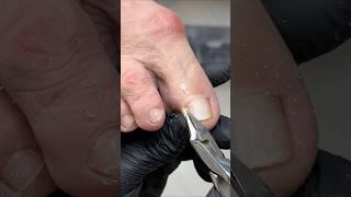 She Walks Pain-Free After This Fix!