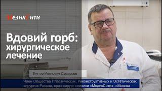 Климактерический горб. Клиника "МедикСити"