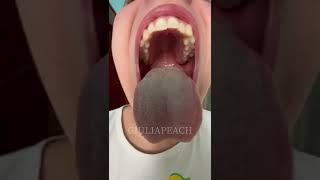 Do you like my MOUTH? 