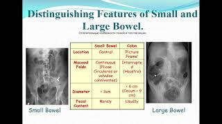 16:40-18:10 Radiological diagnosis of diseases of the digestive system