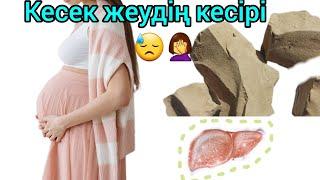 КЕСЕК,БОР жеу пайдалы ма зиян ба?@saltanatturebekova #кесек#боржеу