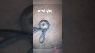 navel torture