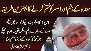 Maida Ke Zakham Ka ilaj | Maida Ka Alsar | Stomach Ulcer | Stomach infection Ka ilaj Dr Sharafat Ali