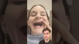 Replacing ALL Teeth With Implants