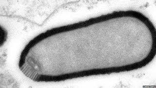 Virus Resurrected After Being Frozen For 30,000 Yrs - Pithovirus Sibericum