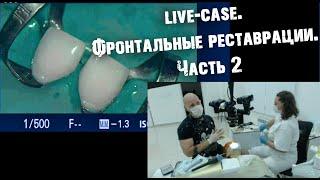 Live-Case.Фронтальные реставрации. Часть 2