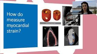 Introduction Strain Symposium by Dr. Victoria Delgado - EACVI