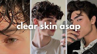 how to get clear skin for guys asap (no bs guide)