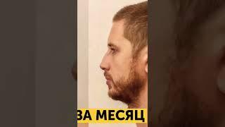 КАК БЫСТРО РАСТУТ ВОЛОСЫ? #shorts #факты #интересно
