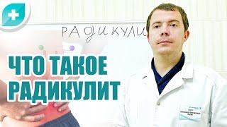 Что такое радикулит