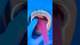 Is that Mr Kiwi? Why Slime tho? #DiscountDentist #MrKiwi #EmergencySurgery