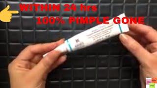 Effective Spot Treatment for Pimples & Breakouts + 100% effective in 24 hrs|how|when|what