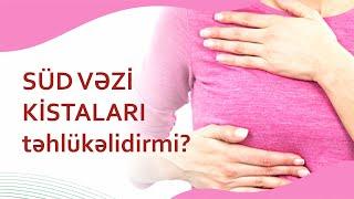 Süd vəzi kistaları təhlükəlidirmi?  Müalicəyə ehtiyac varmı?  #südvəzikistaları #onkoloq